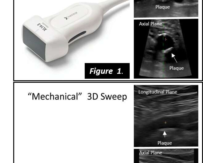 3D matrix ultrasound accurately identifies cardiovascular injury in healthy individuals