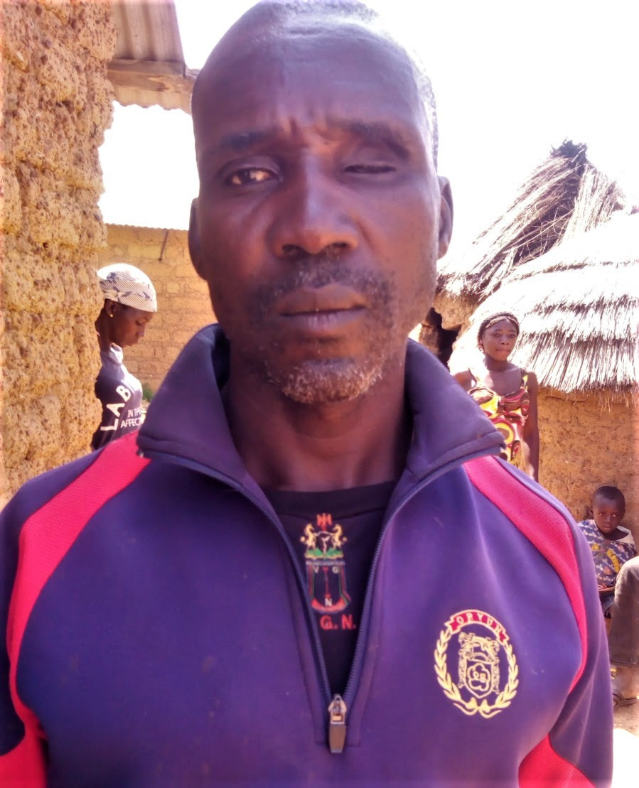  Danladi Musa, shot in eye in Muslim Fulani attack in Ariri, Nigeria in July 2018. (Morning Star News)