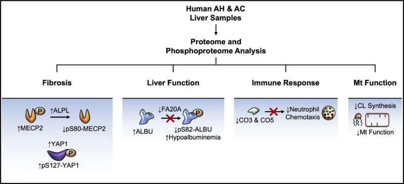 Researchers identify factors that contribute to alcoholic liver disease