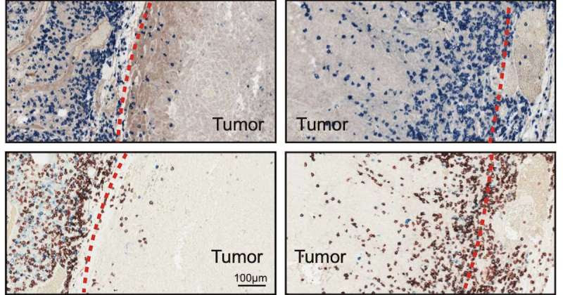 Cancer cells selectively load ‘drones’ to keep T cells from infiltrating tumors