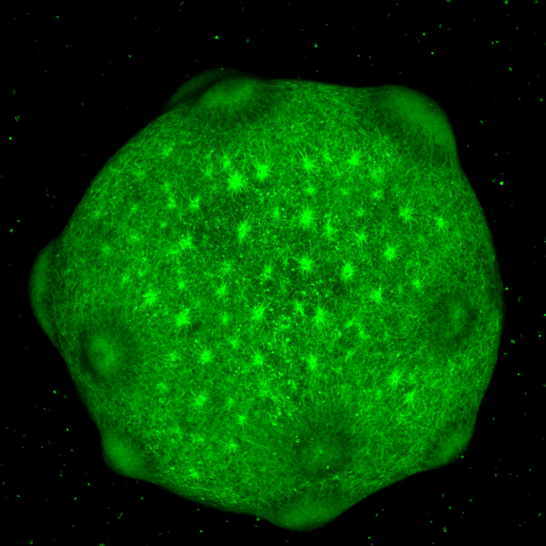 A brain organoid resembling the cerebral cortex.