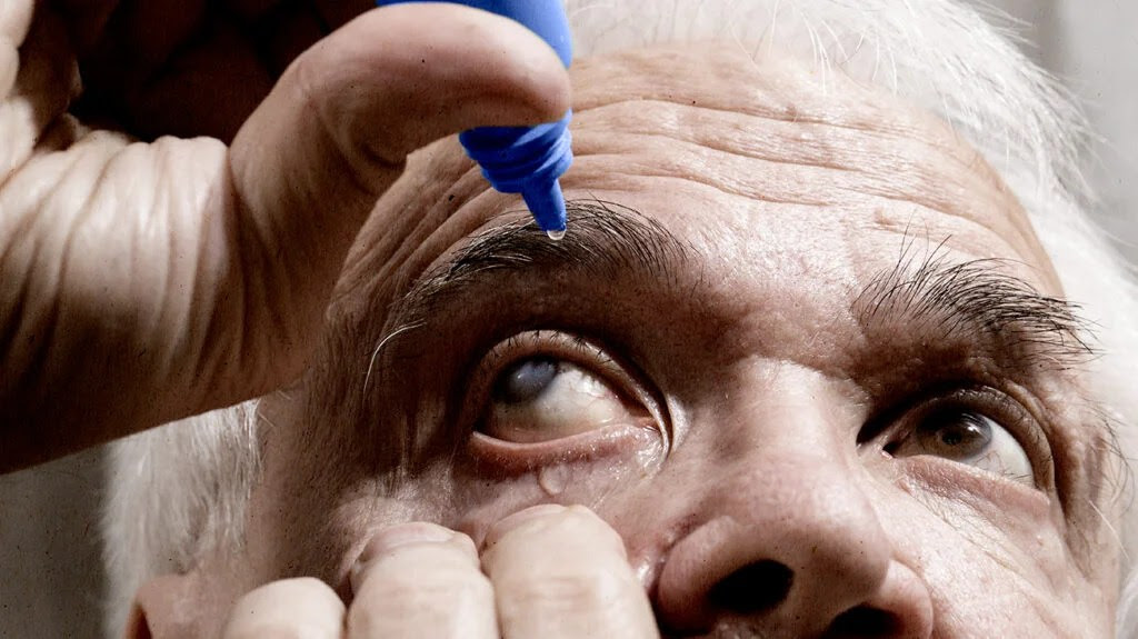 a man applying dry eye gel drops