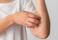 Tratamentos dermatológicos ajudam a tratar a lesão de pele