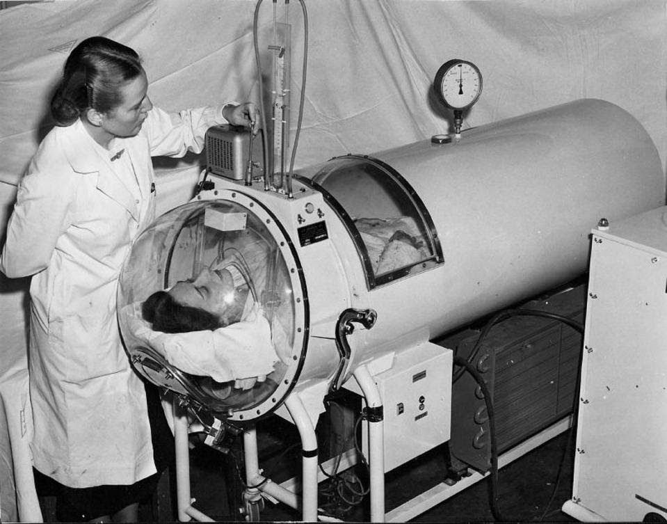 polio patient in iron lung