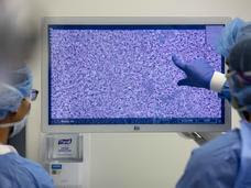 Researchers analyze images of brain tumor biopsies on a computer screen.