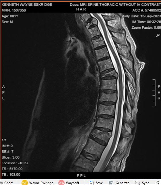 Spine_MRI.jpg