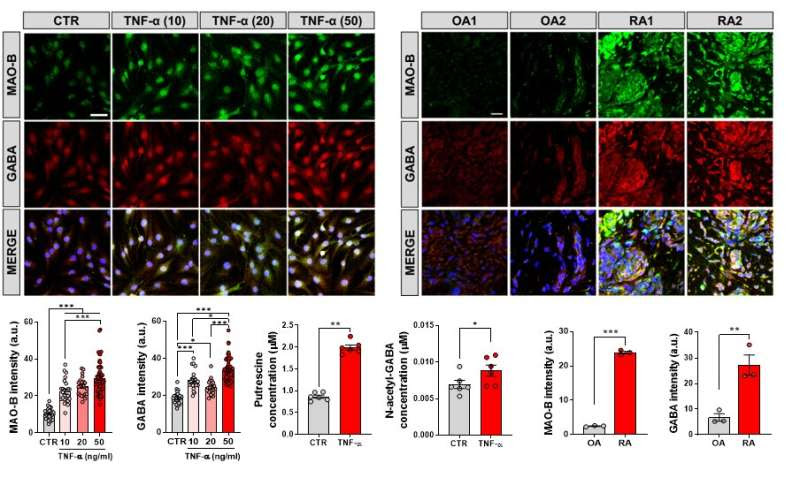 Two birds one stone strategy to treat both joint pain and cognitive impairment in rheumatoid arthritis