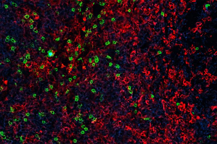 An image of mouse cancer cells (blue) being attacked by a boosted number of CAR T cells (green) and macrophages (red)