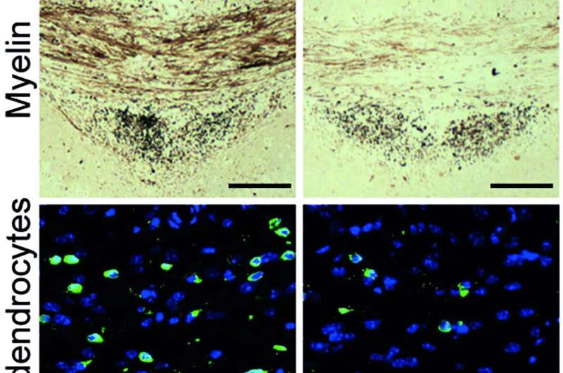 Strategies for the regeneration of myelin