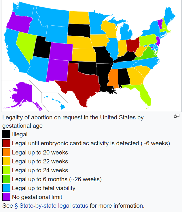 Abortion map od USA