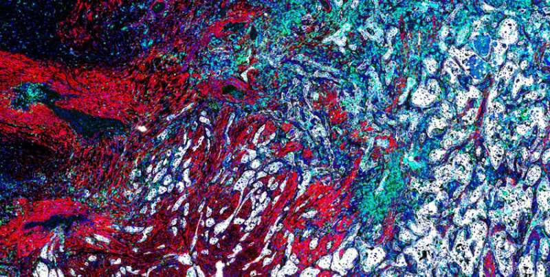 A new tool makes high-resolution imaging data on human tissues easier to understand and use