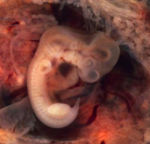 Embryo