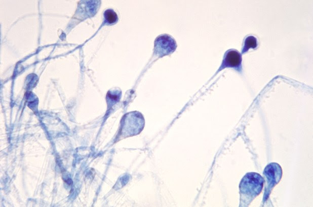 Spores pf the Mucormycosis fungus