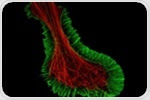 Olympus IXplore SpinSR10 imaging system enables researchers to observe fine details in live cells