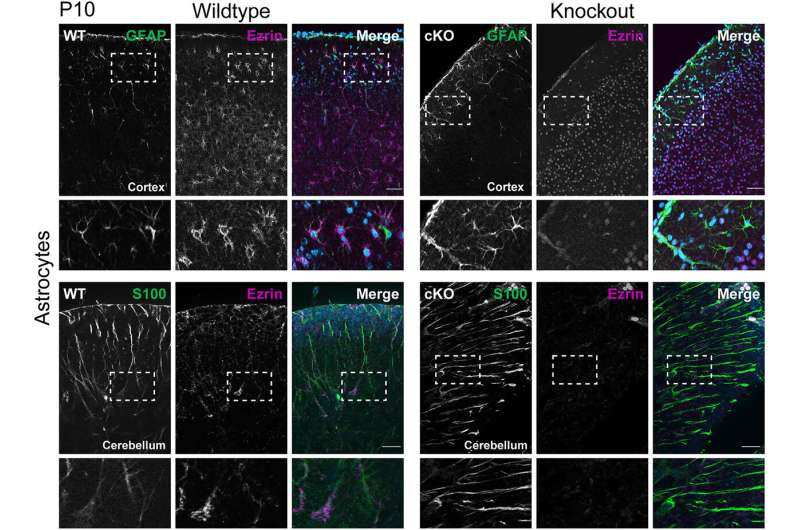 Well-armed – How the absence of a protein could help people better cope with the consequences of a stroke