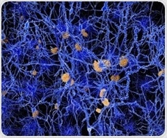 Researchers awarded grant to repurpose FDA-approved drugs for treating Alzheimer's patients