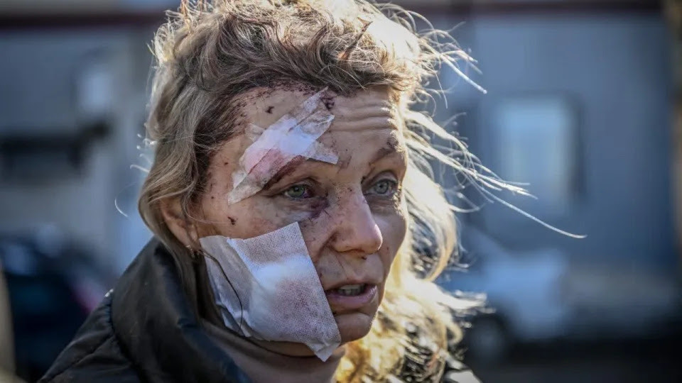 A wounded woman stands outside a hospital after the bombing of the eastern Ukraine town of Chuguiv on Feb. 24, 2022. <span class=copyright>Aris Messinis/AFP via Getty Images</span>