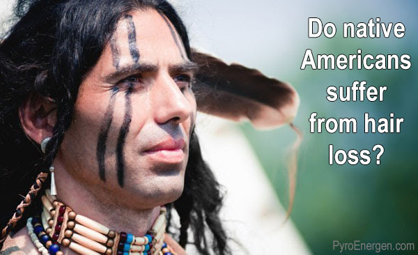 Do native Americans suffer from hair loss?