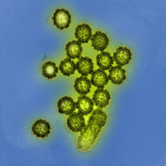 H1N1 virus particles