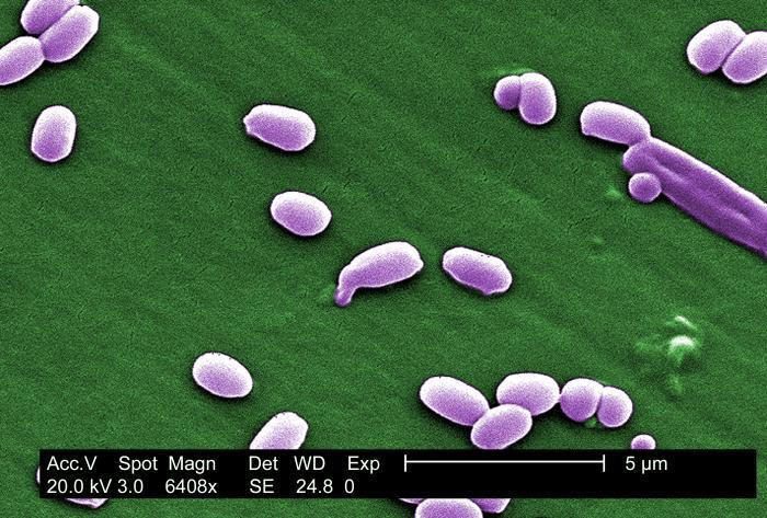 Bacterial endospores from the Aimes strain of Bacillus anthracis bacteria. Credit: CDC/ Laura Rose