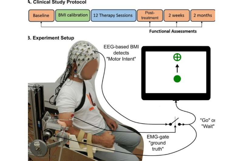 Tapping the brain to boost stroke rehabilitation