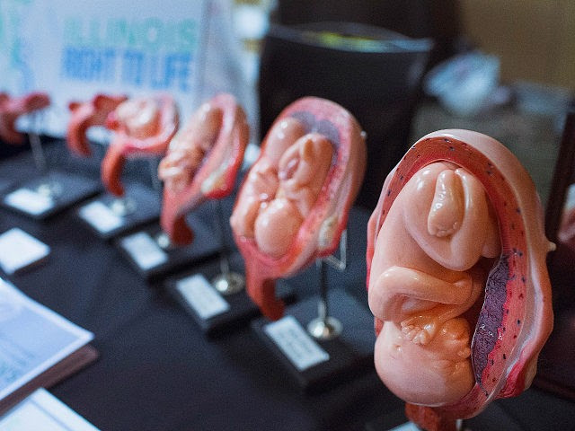 TINLEY PARK, IL - JULY 31: Stages of a fetus are displayed at t