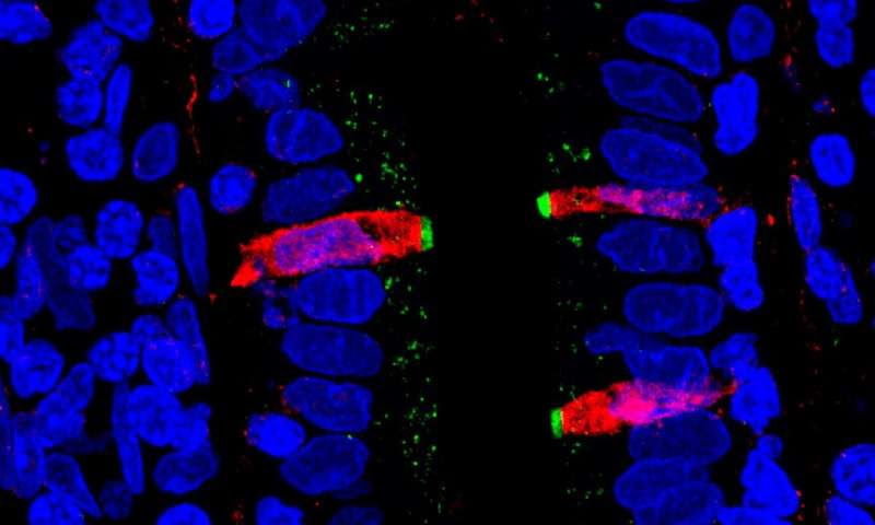 Scientists map entire human gut at single cell resolution