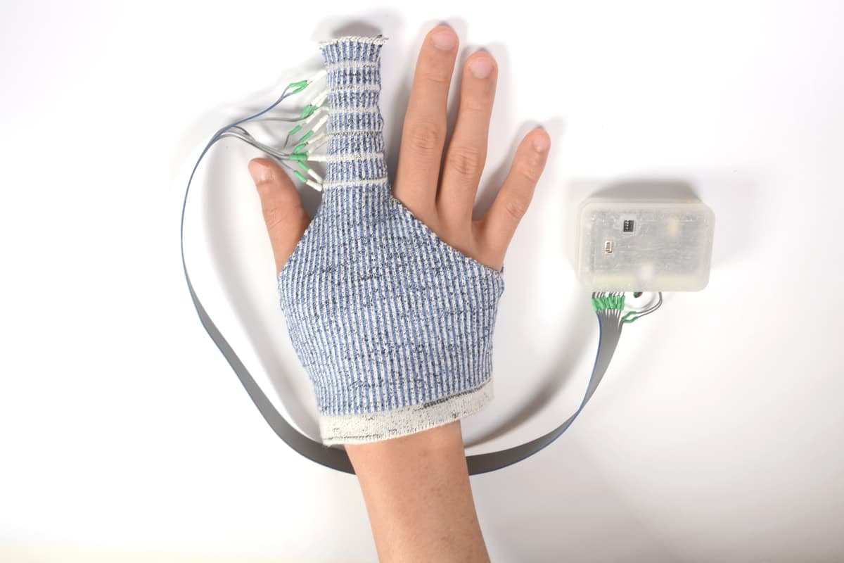 The prototype hand-edema-treating KnitDema glove