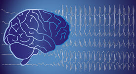 image of brain and brain wave activity