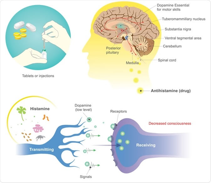 solved-people-with-allergies-commonly-take-antihistamines-with