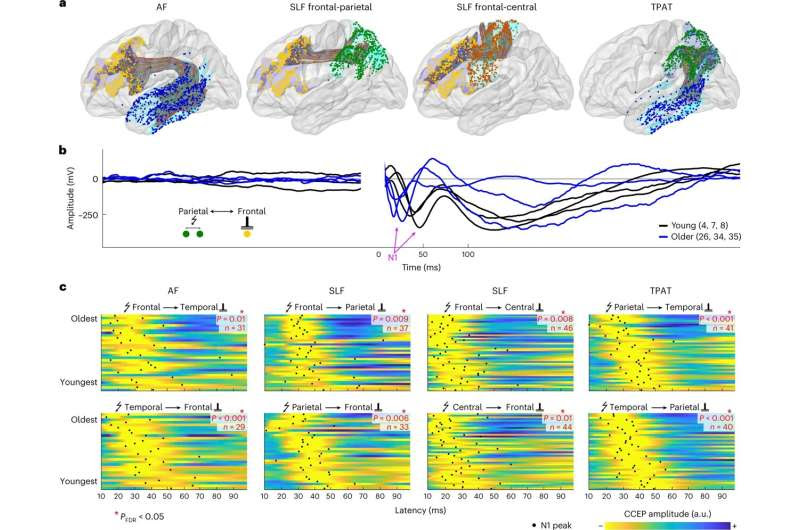 Mental decline comes later than previously thought