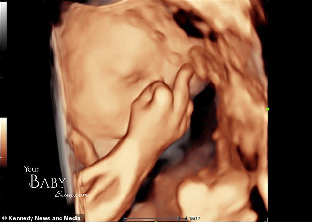 Unborn baby boy stuns parents when a 4D scan shows him giving them the middle finger ?(Photos)