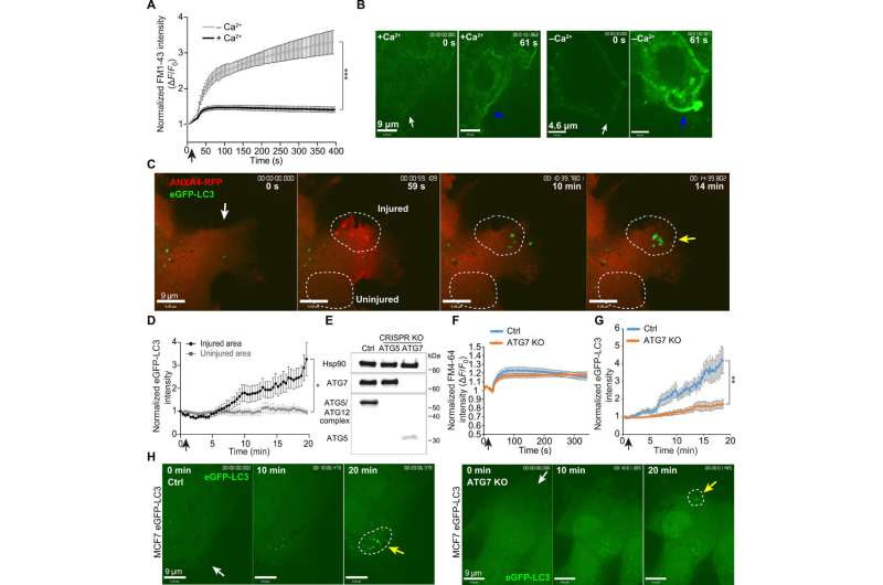 Cancer cells eat themselves to survive