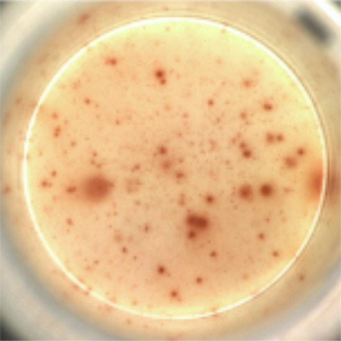 The picture shows staining for engineered cells that secrete the antibody against HIV.