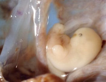 Early embryonic development It
develops in a surprisingly ordered,continuous and gradual is the same organism that after eight weeks will reveal human form