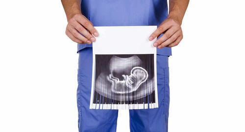 abortion-doctor-baby-ultrasound