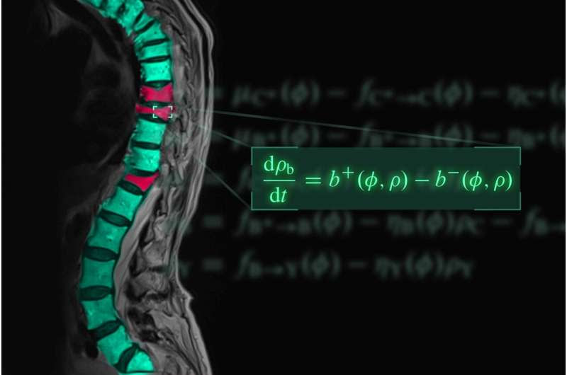 New model can predict best drug combinations for osteoporosis