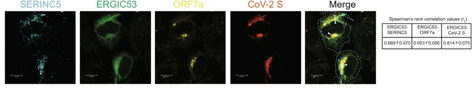 co-location of SERINC5, ORF7a, and SARS-CoV-2 Spike protein in the ERGIC.