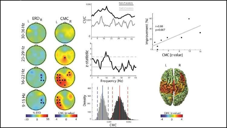 Brain-robot therapy reroutes motor pathway in stroke patients