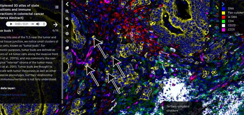 A new tool makes high-resolution imaging data on human tissues easier to understand and use