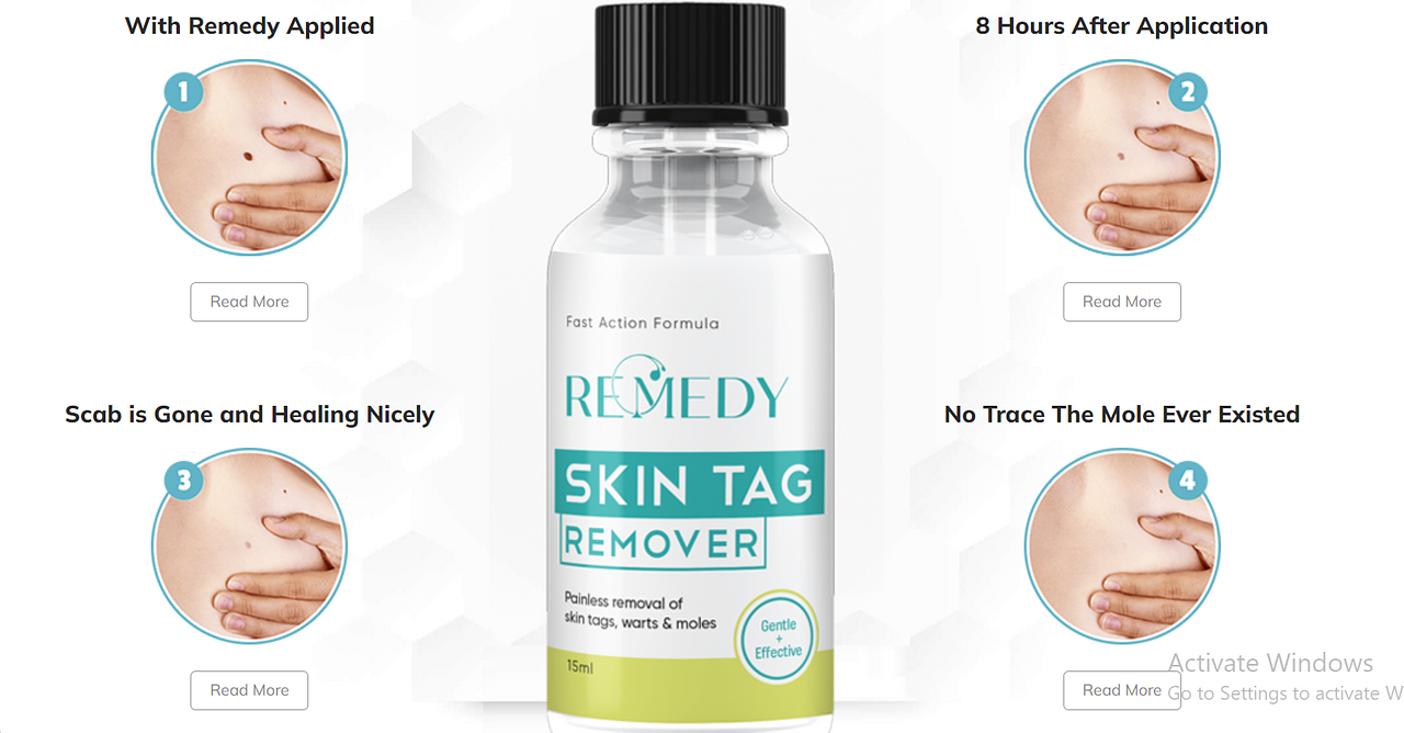 https://applyfortrials.xyz/offer/remedy-skin-tag-remover-usa/