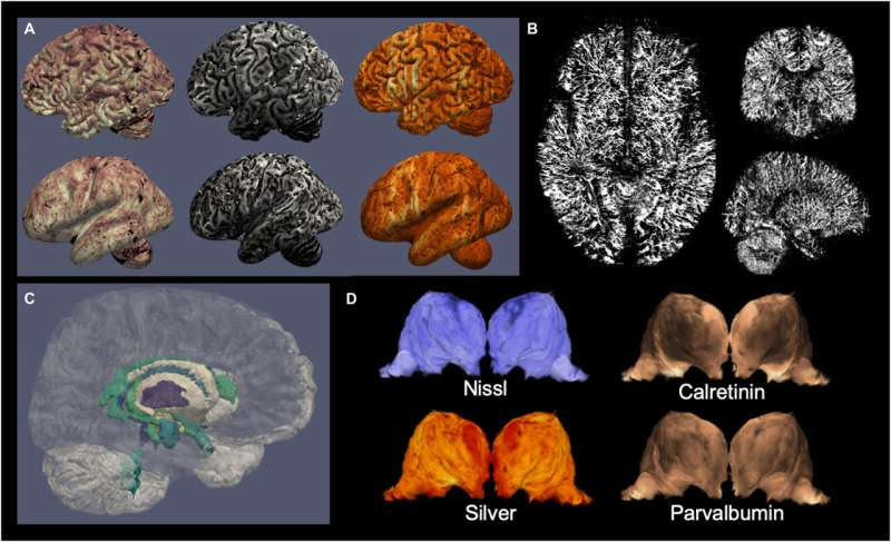 Scientists create highly detailed 3D reconstructions of the human brain