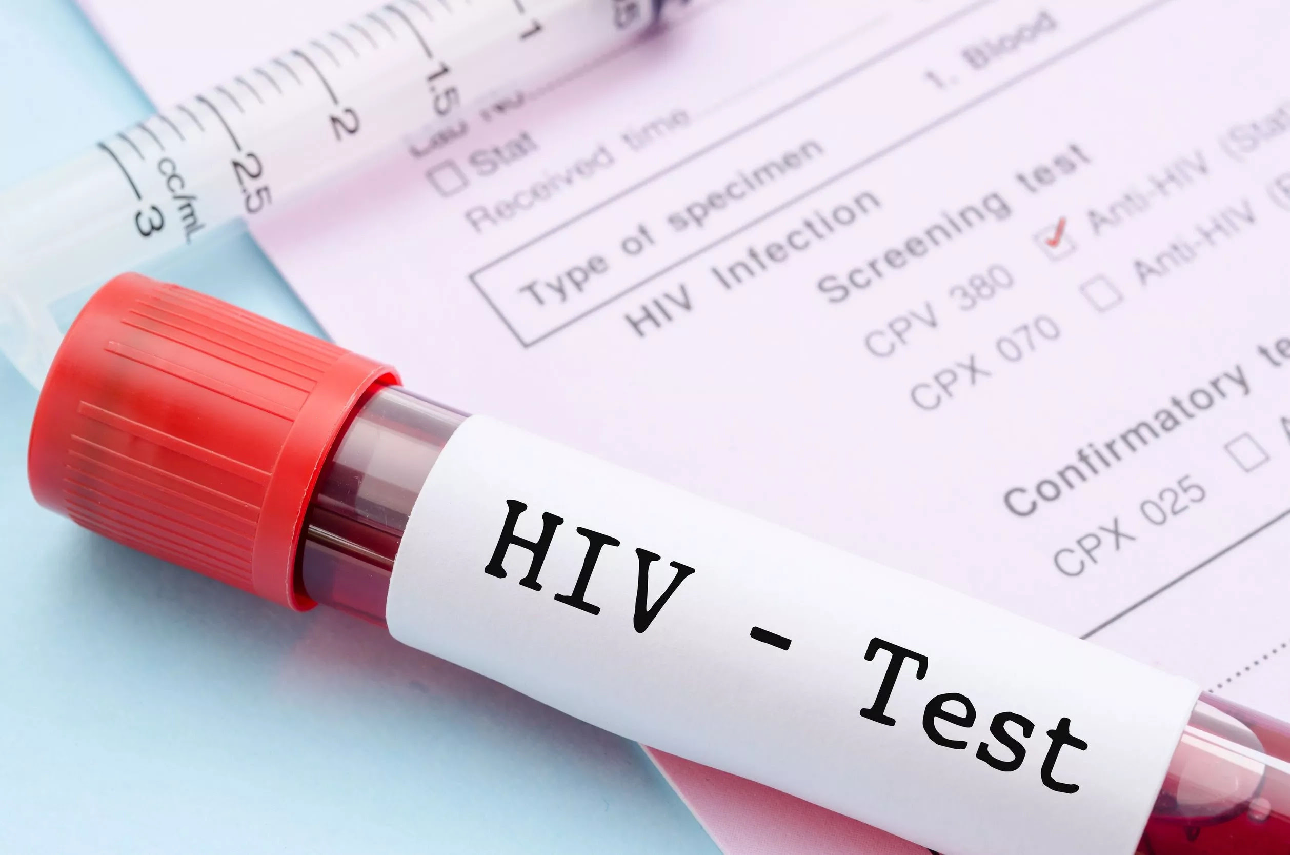Early Signs of HIV in Men: What Symptoms Should You Look out For?