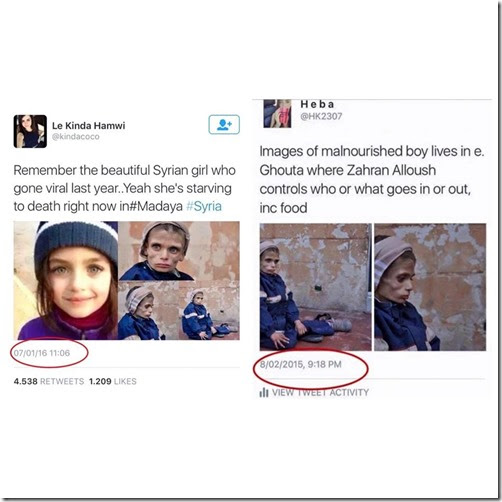 Madaya - foto uitgehongerd meisje