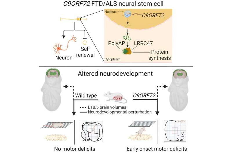 ALS and frontotemporal dementia show origins in utero, according to new study