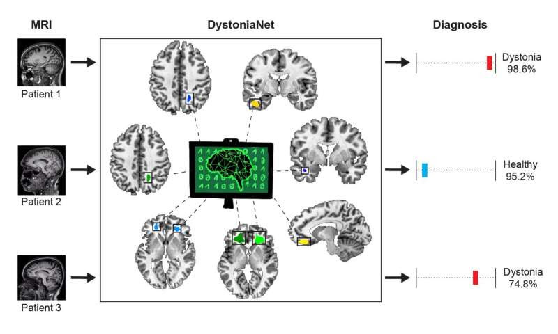 Artificial intelligence platform diagnoses dystonia with high accuracy in 0.36 seconds