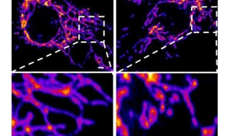 The novel coronavirus' spike protein plays additional key role in illness