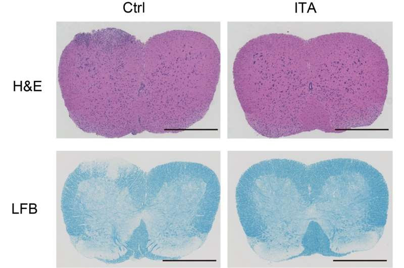 A common metabolite may help treat autoimmune diseases