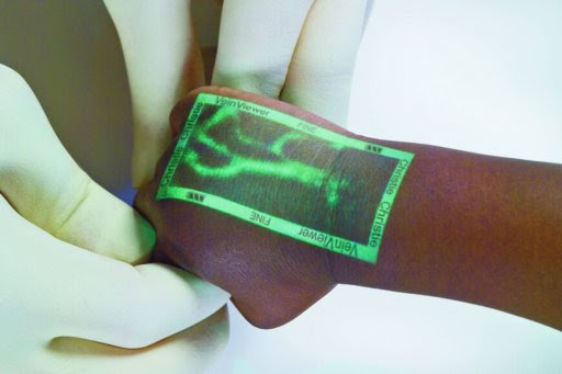 VeinViewer Means No More Poking People Relentlessly to Locate Veins