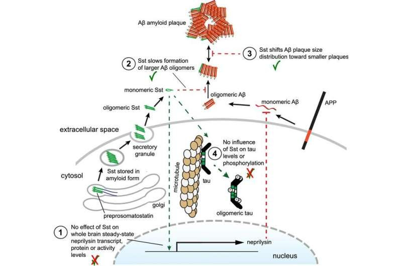 Research challenges long-held view of early-stage Alzheimer's disease